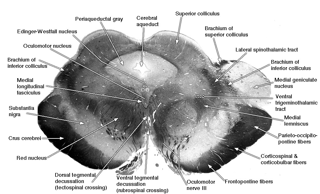 University at Buffalo Neuroscience Slide Atlas